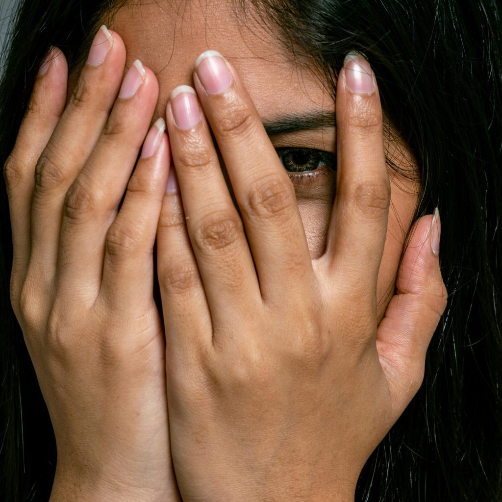 Close-up of woman covering part of her face with hands, revealing one eye.